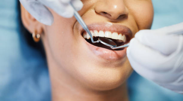 Best Emergency Dentist for Knocked-Out Tooth in Dunellen, NJ